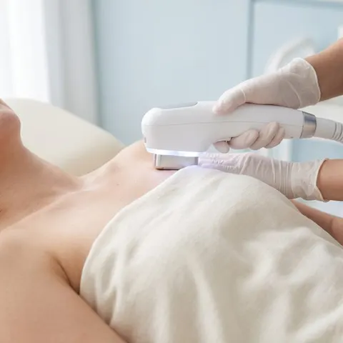 Cryo hair removal full chest at Serenity Beaute Singapore
